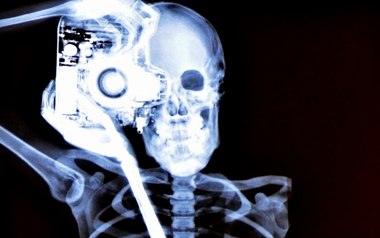 Új, korszerű röntgen gépek Cegléden