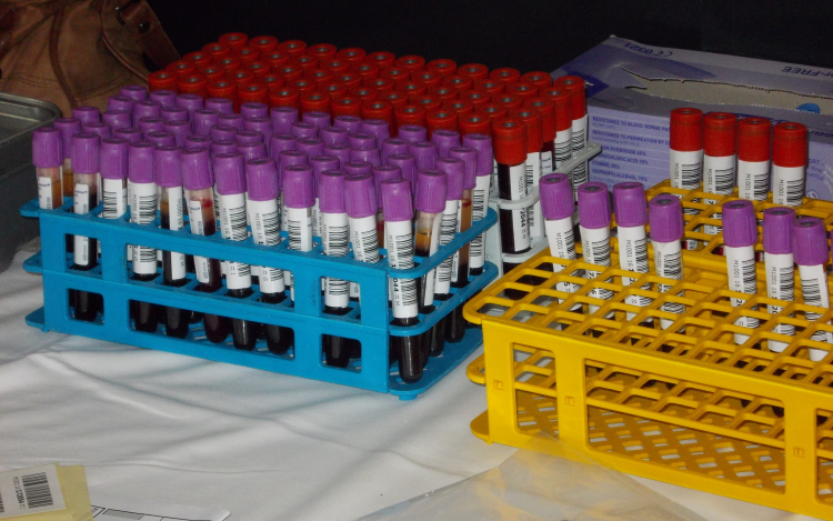 Minden csepp számít!