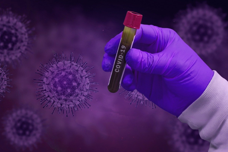 Kutatók vizsgálják, hogy a Covid-19 okozhat-e 2-es típusú cukorbetegséget